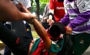 Parte médico de Pablo Grillo, el fotógrafo atacado por policías en la marcha de los jubilados