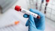 El VIH causó 1,3 millones de nuevas infecciones y 630.000 muertes relacionadas en 2024