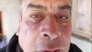 Cachi: un árbitro fue brutalmente golpeado tras un partido y hay dos imputados