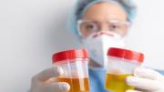 Dile adiós a la infección urinaria con esta infusión natural: esta es la mejor hora para consumirla