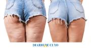 Cómo reafirmar la piel y disminuir la celulitis