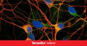 Científicos reciben importante subsidio internacional para hallar tratamientos contra el Alzheimer