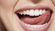 Por qué usar agua oxigenada para lavarme los dientes