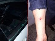 Agredió a policías, destruyó patrulleros y al rato quedó libre: Fue entregado livianamente a sus padres