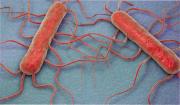 Qué es la listeriosis y quiénes pueden padecer la enfermedad que se detectó en algunos quesos de Tucumán