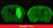 Especialistas del CONICET lograron frenar un tipo de cáncer cerebral con una novedosa estrategia terapéutica
