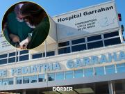 Histórica cirugía en el Garrahan: separan con éxito a gemelas siamesas