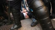 Estoy shockeada y deprimida: el crudo relato de una enfermera agredida en la represión a jubilados