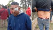Crece la tensión en Hipólito Yrigoyen tras una brutal represión: un trabajador perdió un ojo