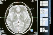 El cerebro humano: un órgano en constante transformación que define quiénes somos