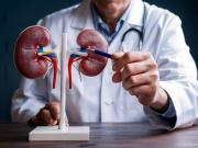 Qué causa los cálculos renales y cómo prevenir este doloroso problema