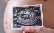 Cómo son los embarazos en robots, que prometen nuevos tratamientos de fertilidad