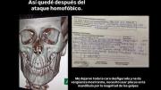 Brutal golpiza a un joven gay en Palermo 