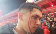 Fotos y videos de la barbarie que no se vieron en TV en Independiente vs. U. de Chile