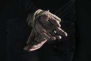 Lo asaltaron y tras brutal golpiza, le amputaron tres dedos de la mano