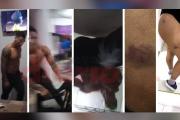 Incalificable: joven madre denuncia las brutales golpizas de su ex delante de la hijita