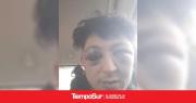 La Policía una vez más apuntada: músico denunció brutal golpiza