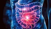 Una investigación revela qué forma de ejercitarse puede proteger contra un cáncer muy común