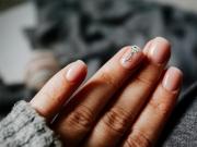 Las 10 alteraciones en las uñas que podrían revelar problemas de salud
