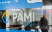 PAMI negó sobreprecios en la compra de lentes y remarcó que el sistema actual garantiza “gratuidad”