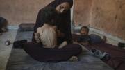 La otra cara de Gaza: al menos 21.000 niños quedaron discapacitados desde el comienzo la guerra
