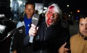 Le rompieron la cabeza a un periodista de América TV en el acto de Milei
