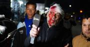 Incidentes en el acto de Javier Milei: peleas, un botellazo a un periodista y piedrazos al auto presidencial