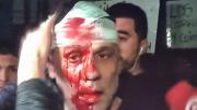 Incidentes en el acto de Javier Milei en Moreno: un periodista fue gravemente herido por un botellazo