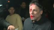 El periodista agredido en el acto de Javier Milei en Moreno rompió el silencio: qué dijo