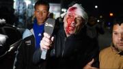 El día después del periodista que recibió un botellazo en el acto de cierre de Milei: Este impacto a un nene lo mata