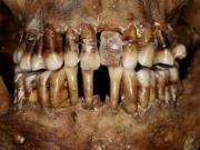 El ingenioso secreto para conservar sus dientes de una aristócrata del siglo XVII