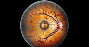 Una cirugía ocular argentina ganó el “Óscar de la retina” tras devolver la visión en un caso extremo