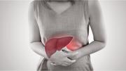 Cuidá tu hígado: estos alimentos pueden contribuir al desarrollo de hepatitis