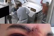 Brutal golpiza en una discusión de tránsito: dos detenidos y un joven con el tabique quebrado