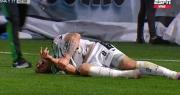 ¡Horrible lesión!: el jugador de San Martín que se fracturó dos dedos y podría perderse varios partidos