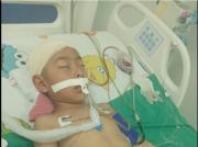 Niño lucha por su vida tras caer de puente defectuoso