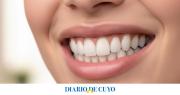 Limpieza dental: la frecuencia que muchos desconocen y recomiendan los expertos