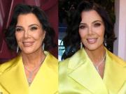 Kris Jenner mostró su rostro tras someterse a un lifting de 100 mil dólares