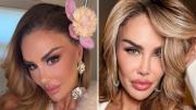 Ninel Conde se opera para cambiar el color de sus ojos