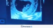 La reacción de un ecografista sanjuanino que se volvió viral al descubrir un embarazo de gemelos