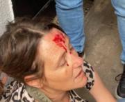 Caos en el Normal 2 de La Plata: un joven irrumpió a los golpes y sembró el pánico