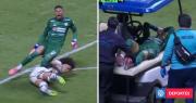 Brutal lesión de Kevin Mier: arquero colombiano sufrió fractura tras patada de rival