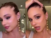 La Miss Universo Argentina sorprende al revelar la afección que sufre en su pelo: “Nací con esta condición