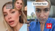 Dejen de autodiagnosticarse: El debate en torno al concepto viral 'cara de cortisol'