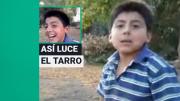 Recuerdas el viral de El Tarro: A 11 años así luce el niño que sufrió una dolorosa caída en bicicleta
