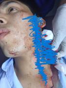 Joven termina con el rostro cortado por evitar un robo