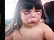 Feroz golpiza a una nena en Gerli: la atacó su padrastro y fue detenido