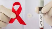 El grupo de 20 a 29 años encabeza los casos de VIH en Salta