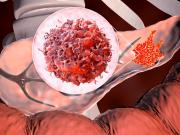 Cáncer de páncreas: de los desafíos a la esperanza