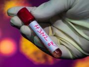 Sedes activó vigilancia epidemiológicatras brote y propagación de “Gripe K”